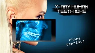 X-Ray Human Teeth Joke Ekran Görüntüleri
