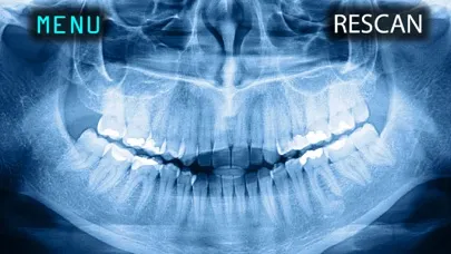 X-Ray Human Teeth Joke Ekran Görüntüleri