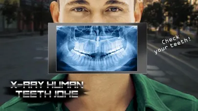 X-Ray Human Teeth Joke Ekran Görüntüleri