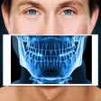 Xray Scanner Teeth Prank Xray Scanner Teeth Prank