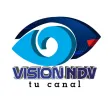VISION NDV VISION NDV