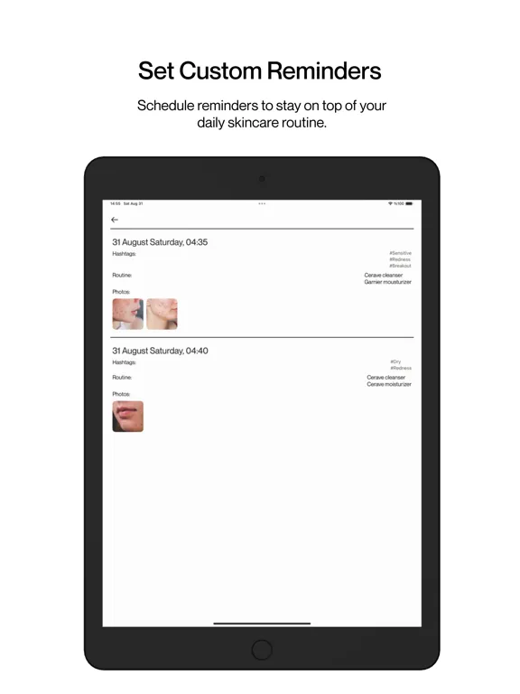 Skin Diary: Track & Glow iPad  Ekran Görüntüleri