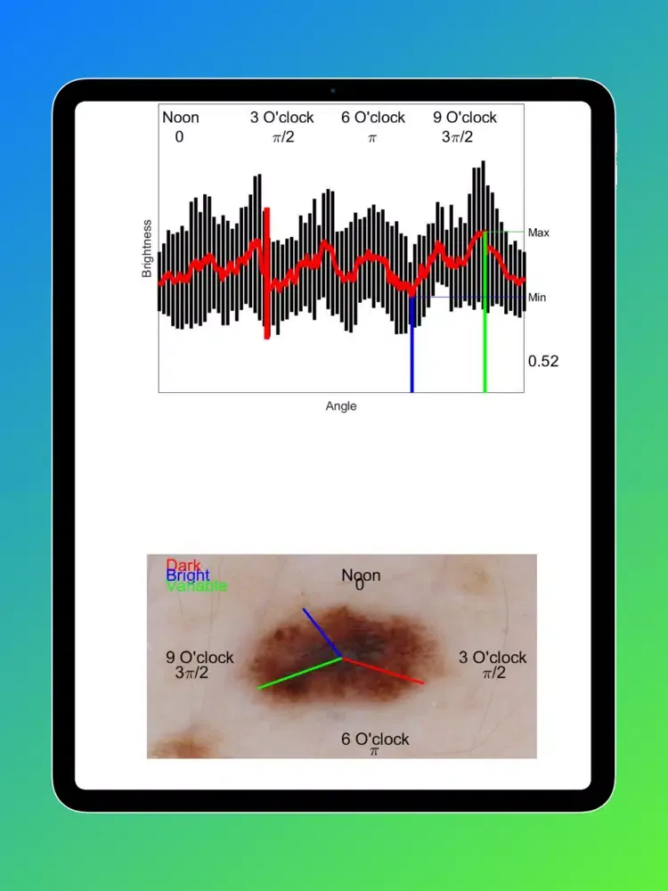 تصاویر Eclass Imaging Biomarkers iPad 