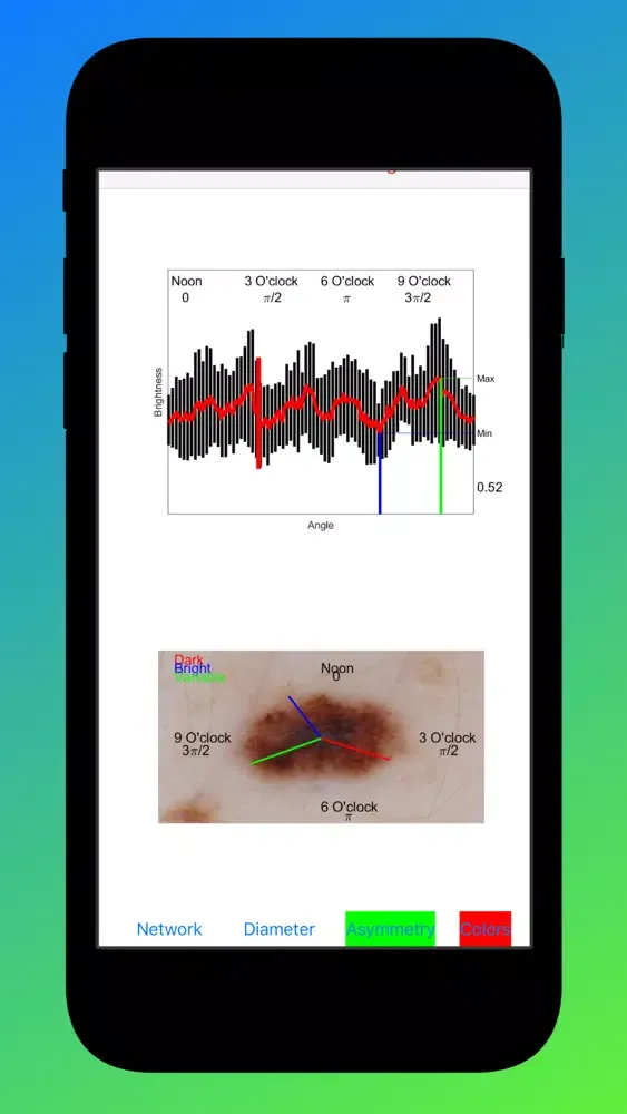 تصاویر Eclass Imaging Biomarkers