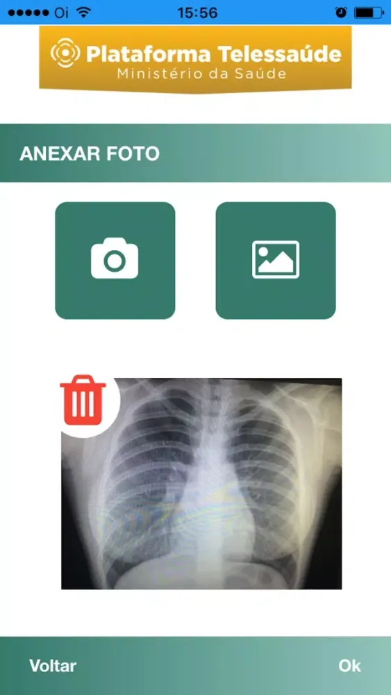 Zrzuty ekranu Plataforma Telessaúde