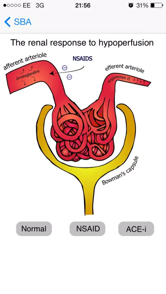 Medical SBA Questions (Finals/MRCP)应用截图