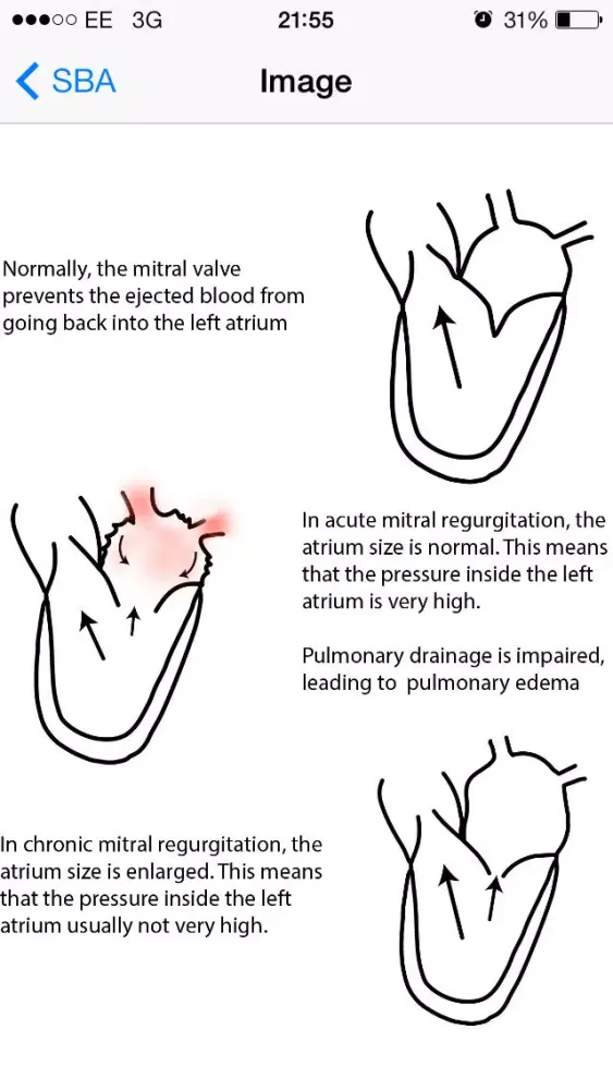Medical SBA Questions (Finals/MRCP)应用截图