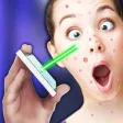 Cure Pimple Laser Simulator Cure Pimple Laser Simulator