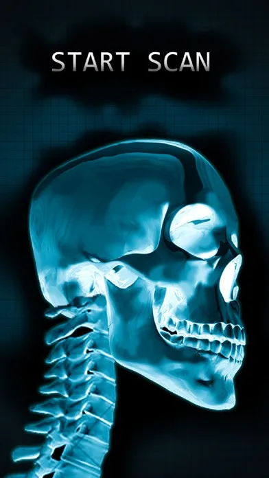 Screenshot di Simulator X-Ray Bone Fake
