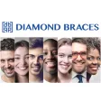 Diamond Braces Diamond Braces